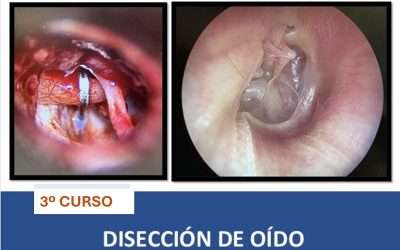 Curso de Disección de Oído