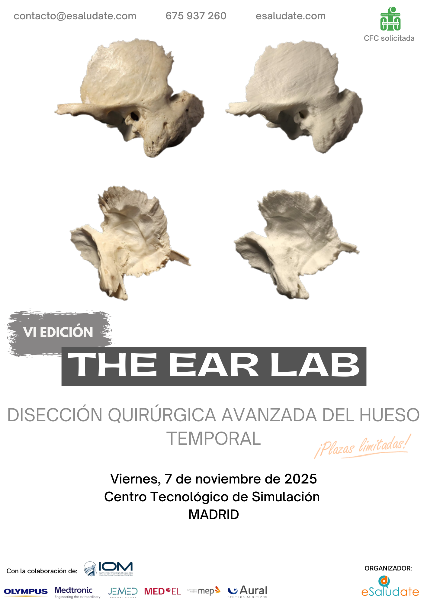 The_Ear_Lab_-_Hueso_Temporal_-_7_de_noviembre_2025