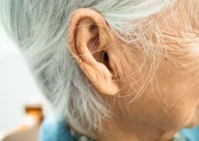 ¿Puede una pérdida de audición alertarnos de un mayor riesgo de demencia años antes?